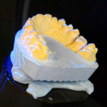 3D scan Apple Vision Pro - Healthcare
