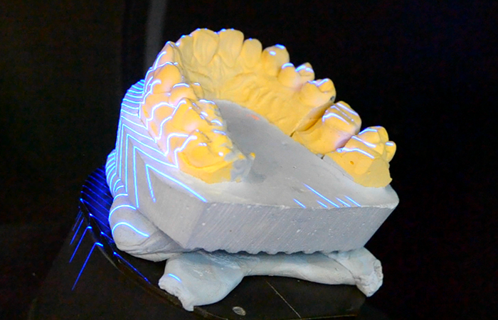 3D scan Apple Vision Pro - Healthcare